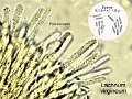 Lachnum virgineum-amf1999-micro